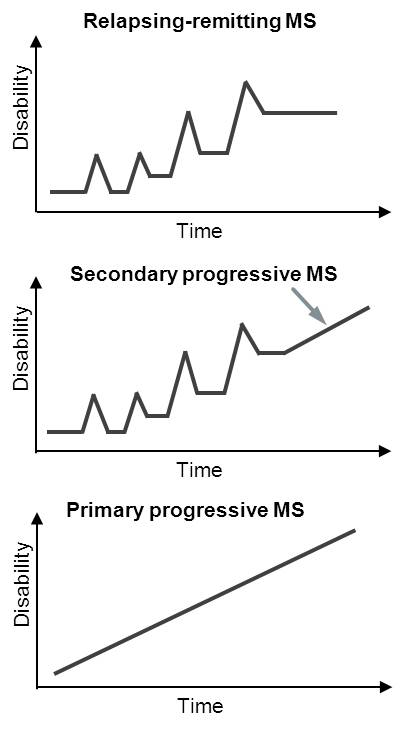 MS course of disease